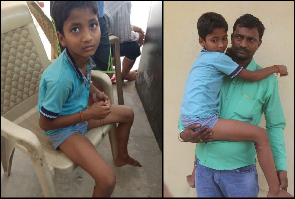 lady made her dog to bite the boy who was picking up the mango from the road