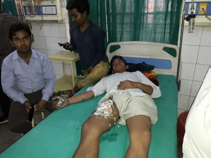 boy injured in mobile phone blast 