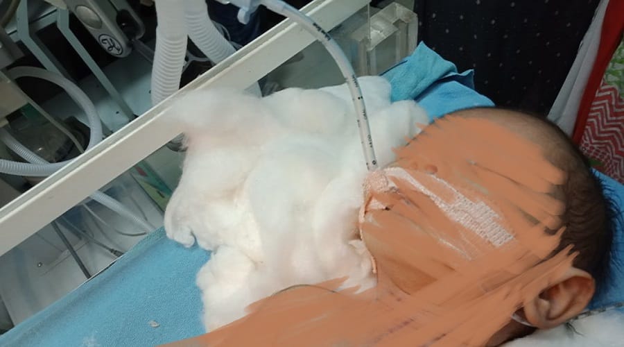 family left the baby girl in the meerut hospital 
