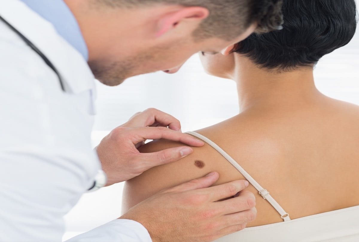 IISc develops bandage that can kill skin cancer cells
