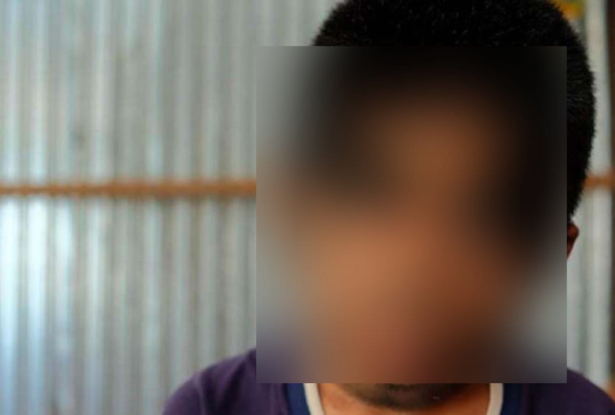 This indonesian boy suffers with genetic disorder called werewolf