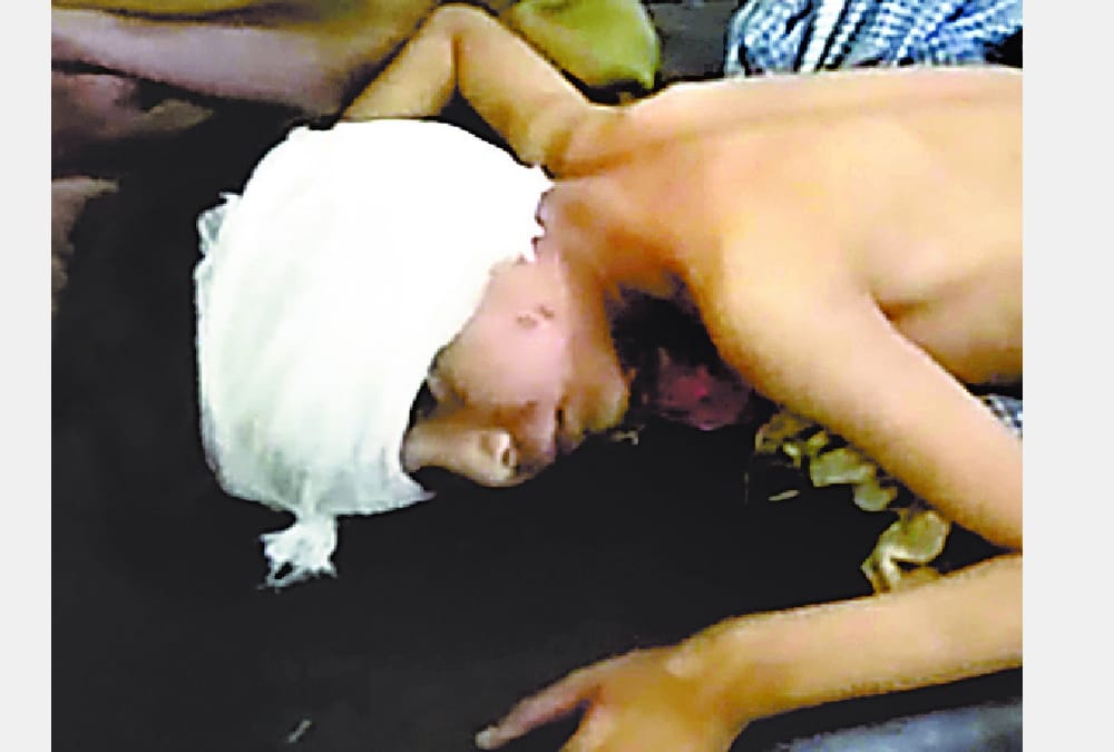 dogs killed another child in sitapur