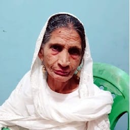 woman died due to hydrofobia