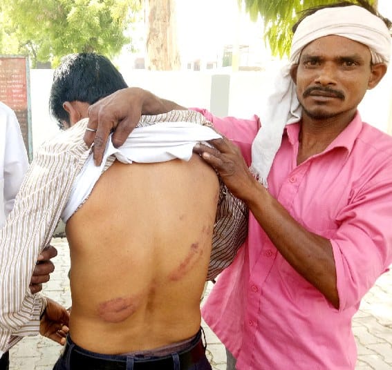 Daily wage worker beaten up by Thakur