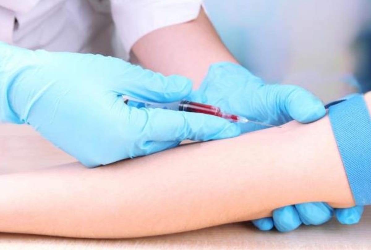   Parents should get checked thalassemia before pregnancy