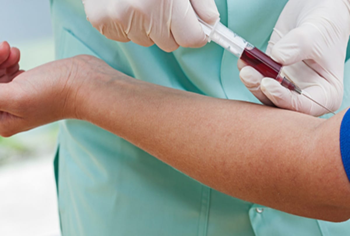   Parents should get checked thalassemia before pregnancy