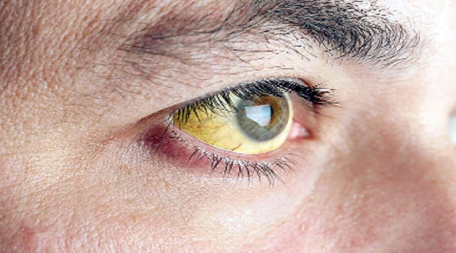 thalassemia should be avoided, Check before marriage