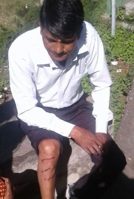 Leopard killer attack on two people