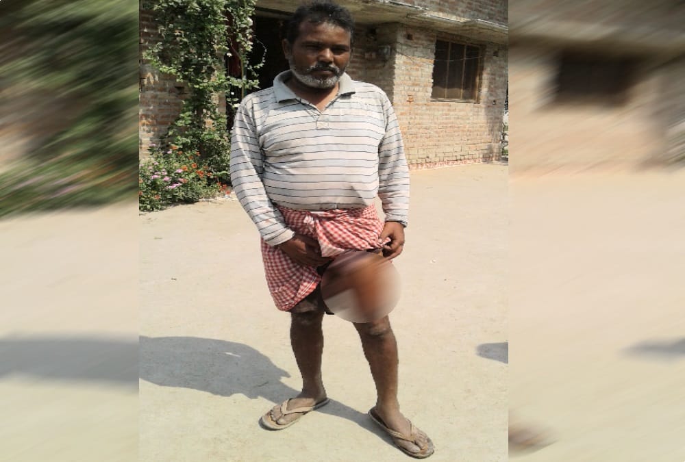 Leopard attack on four peoples badly injured photos