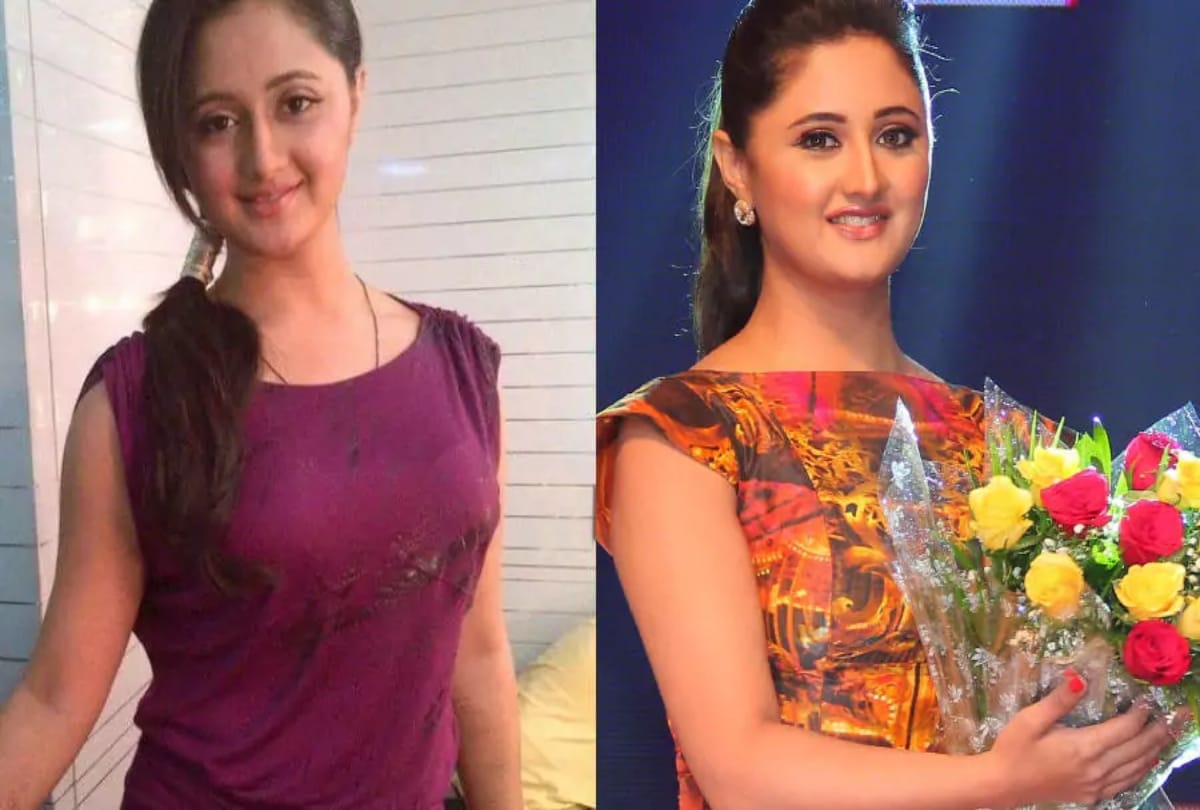 tv actress Rashami Desai suffering from skin Psoriasis disease