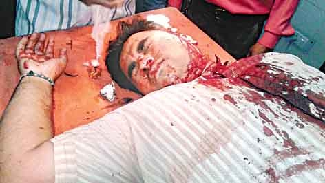 attack on eletric department worker