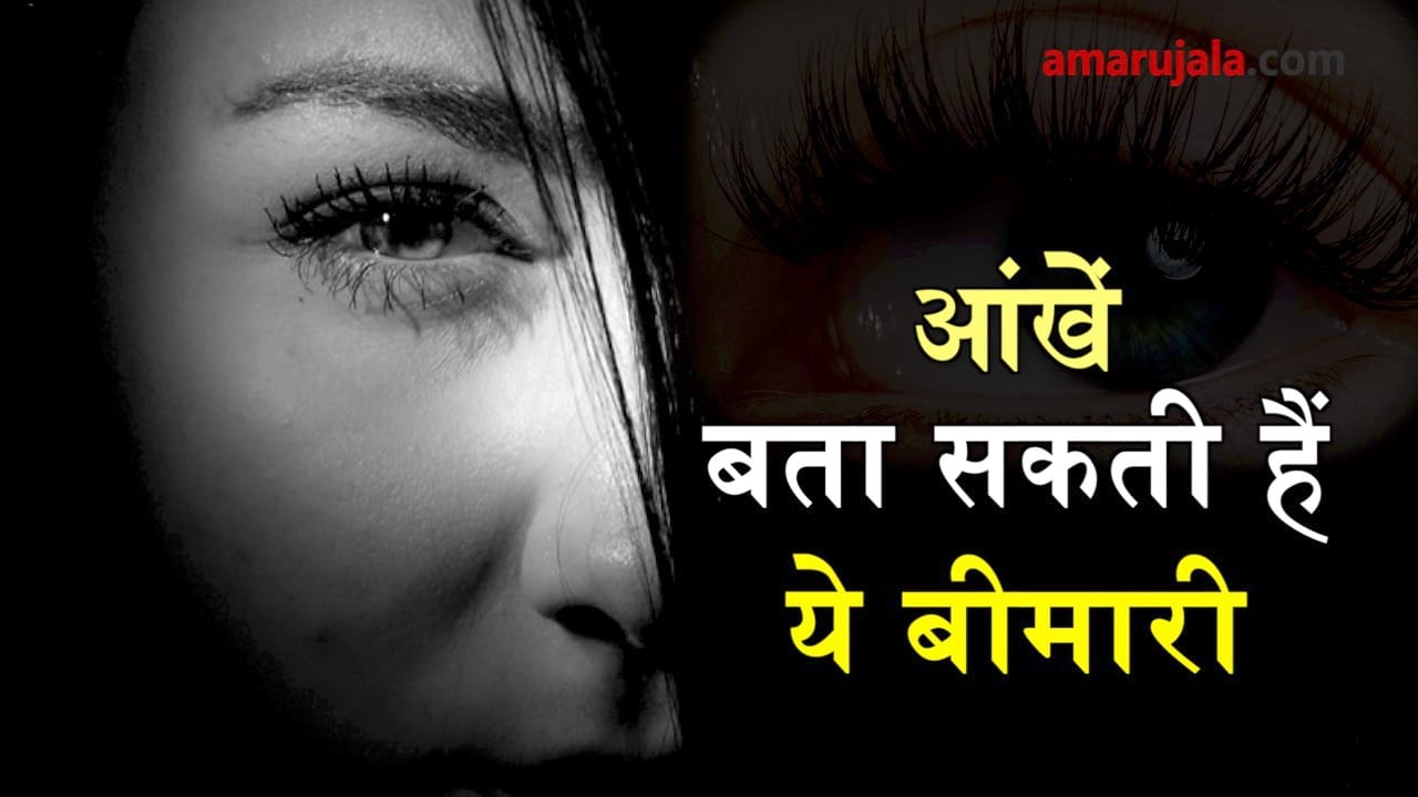 eye color tells you the disease hovering in th body