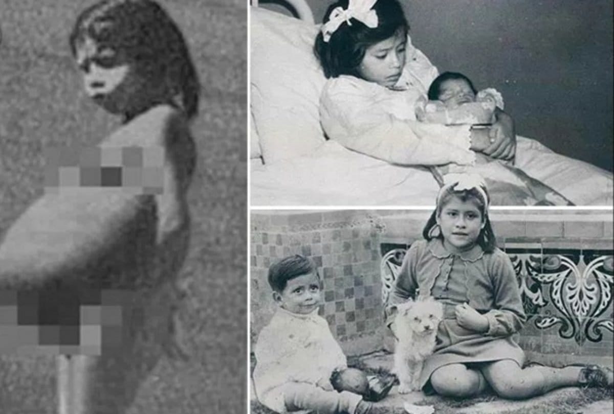 Story of lina medina who is Worlds youngest mother in the age of five she gaves birth to a son