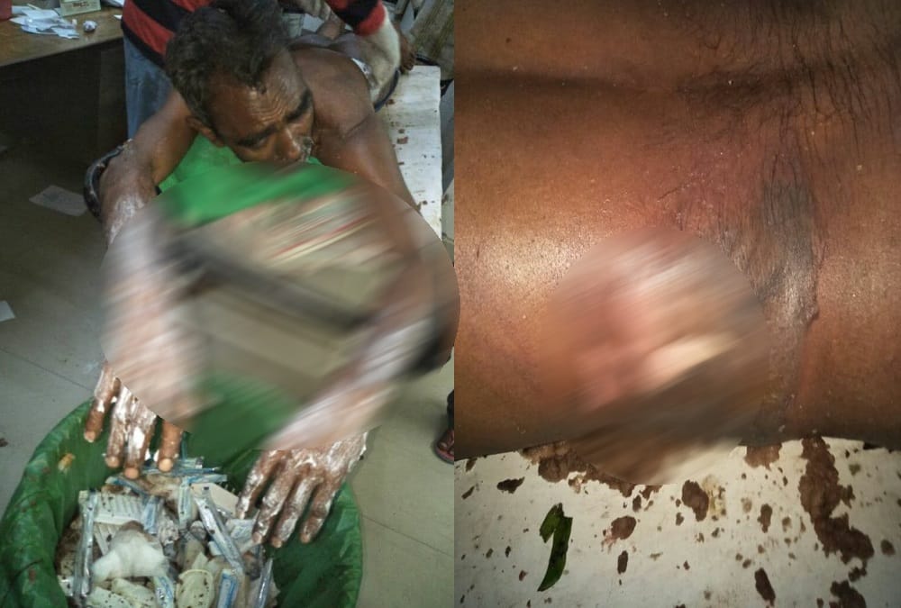 Drunk youths throw shopkeeper into Boiling oil in nainital