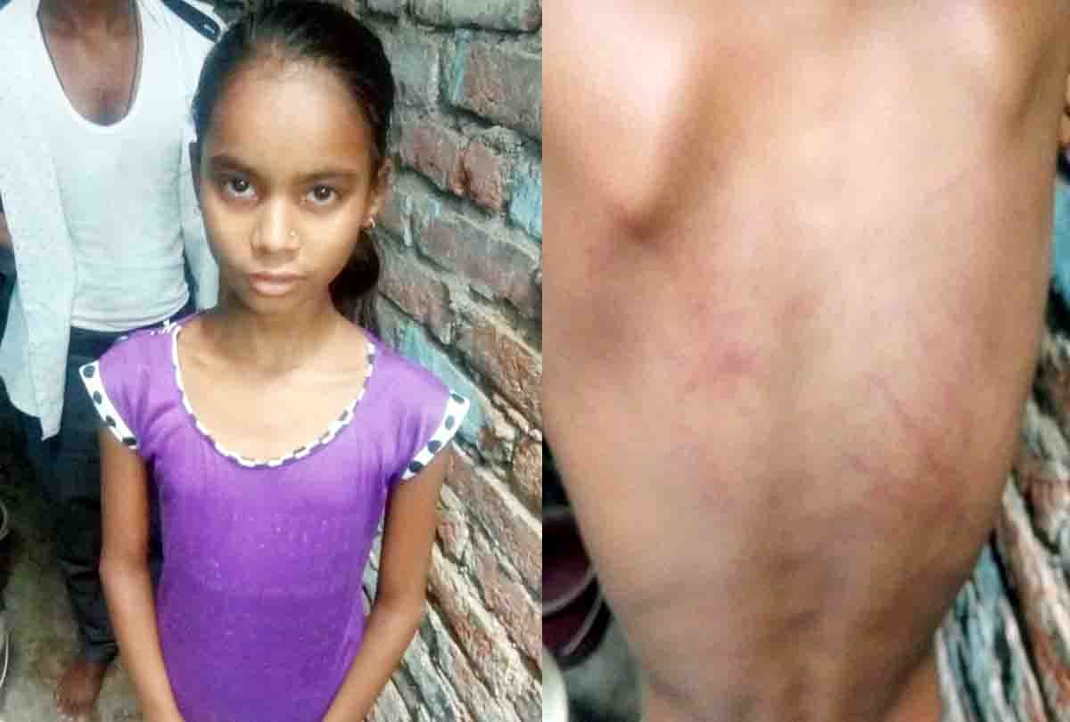  girl was beaten on a sneeze by merciless teacher
