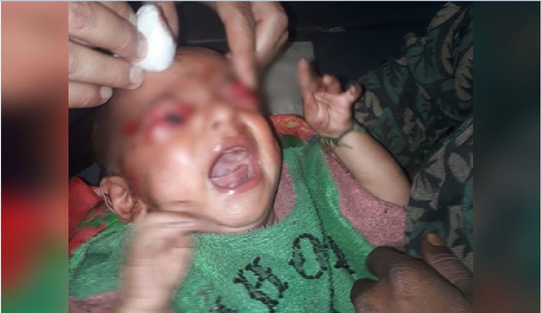crow Pulled out eyes of a six year old children in riasi jammu and kashmir