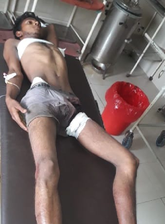 गोरखपुर में जानलेवा बवाल, एक की मौत और तीन को गोली लगी