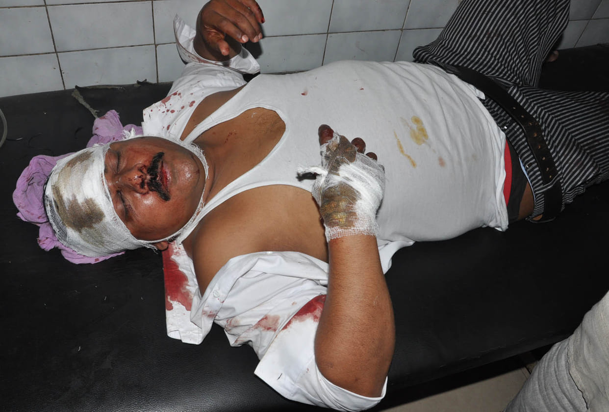 Firing on advocate, injured