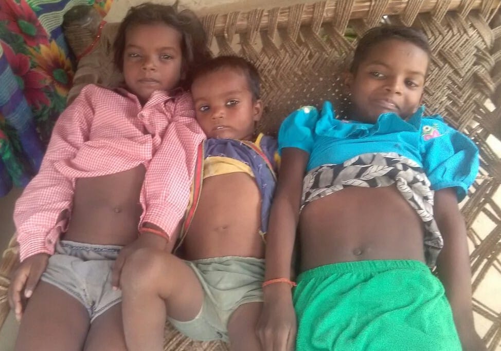 मारहरा, मिरहची के तीन गांवों में फैला चिकनपॉक्स