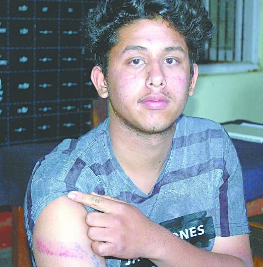 Parents fiercely beaten by the student