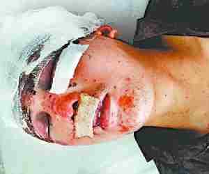 Chinese man found injured