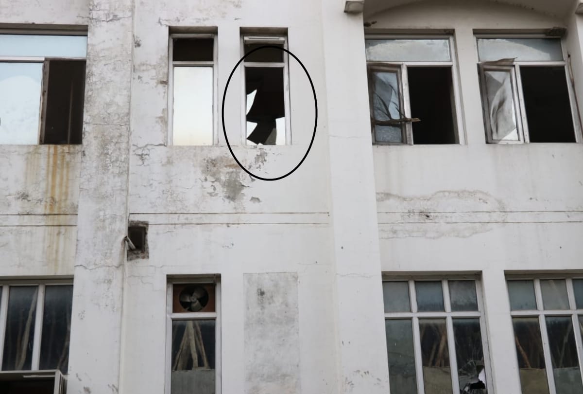 fire in globe hospital, girls injured