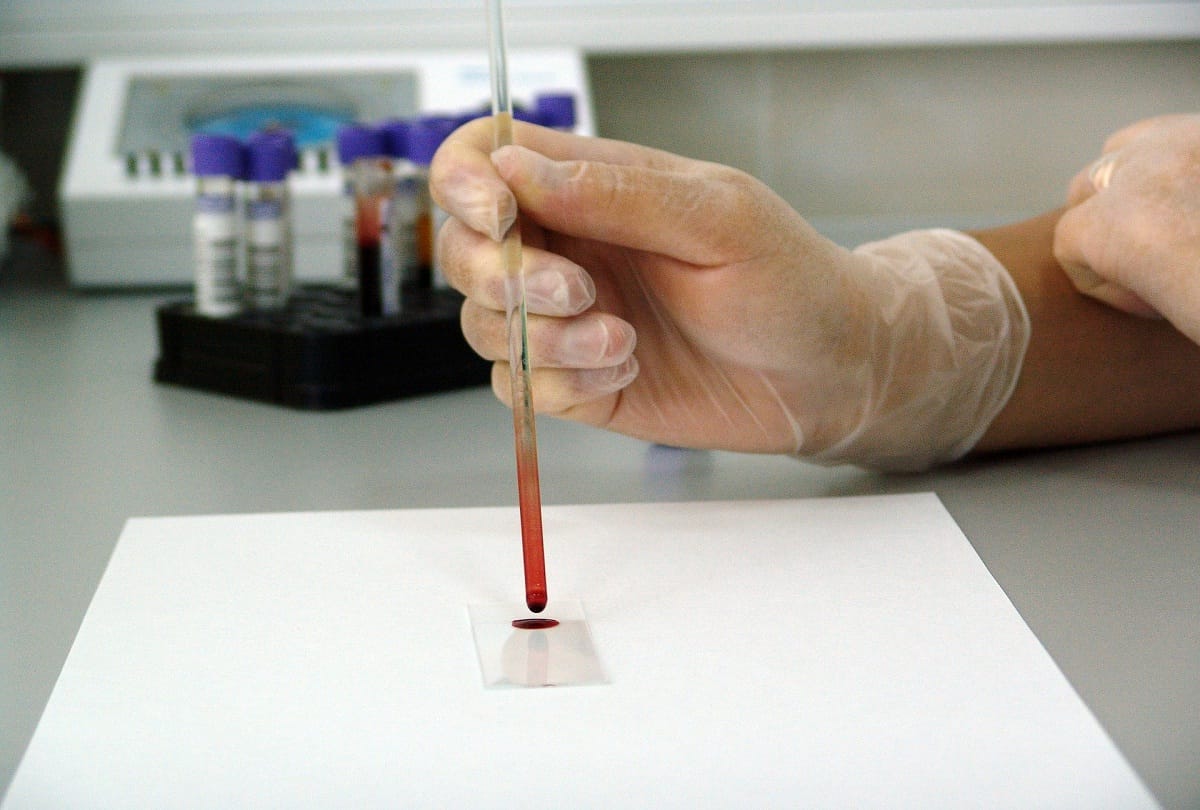 coronavirus test kit make in india first covid 19 testing kit by MyLab Discovery Solutions pune