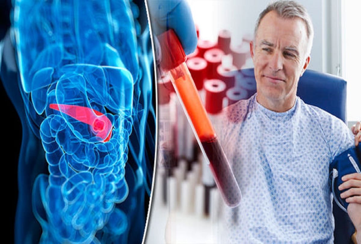 Coronavirus Blood Group A Type: People with bloodgroup A more vulnerable by covid 19 says Study