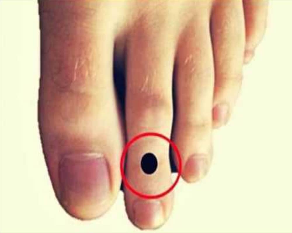 Moles on these parts of body indicates about the bad luck