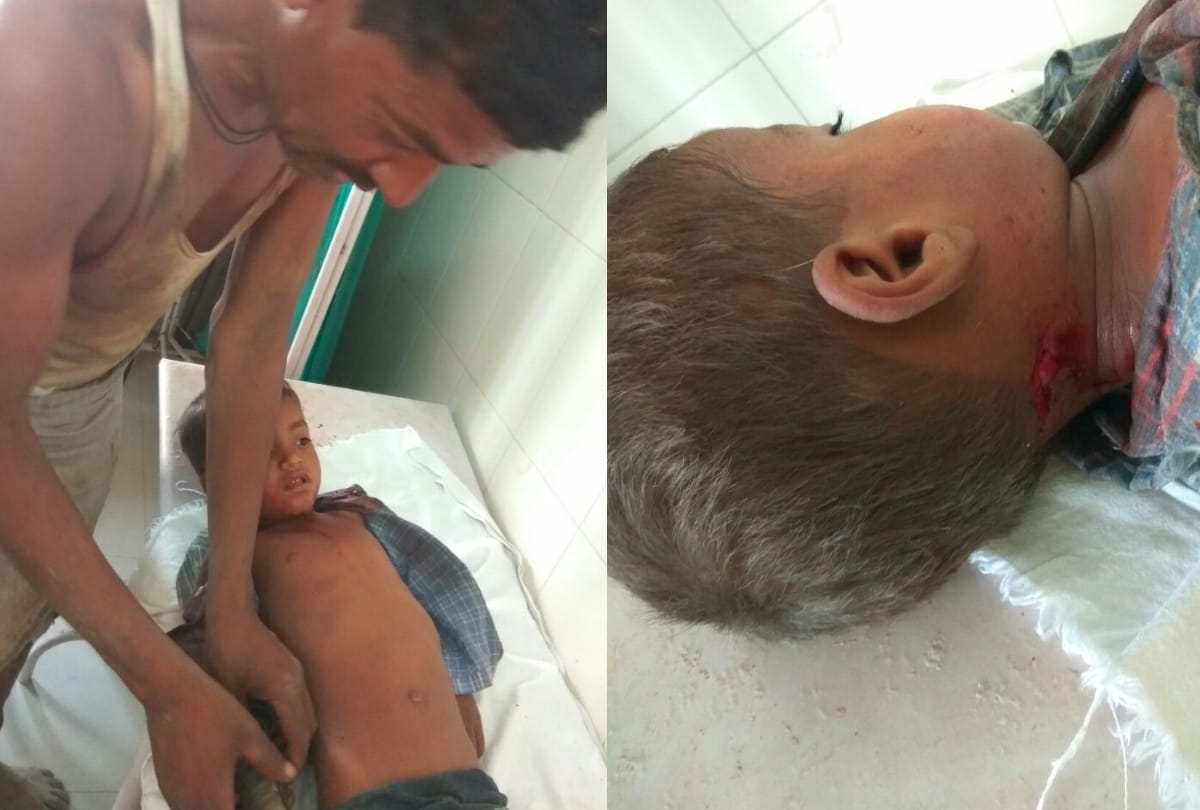 four injured in attack of dogs, angry villagers killed one dog
