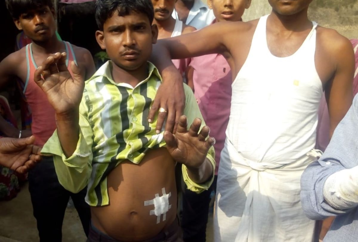 four injured in attack of dogs, angry villagers killed one dog