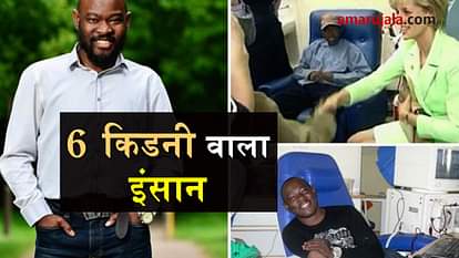 man with 6 kidney