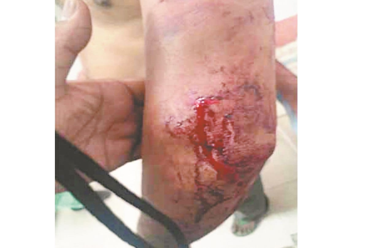 Husband beaten by wife in Sirmour Himachal Pradesh