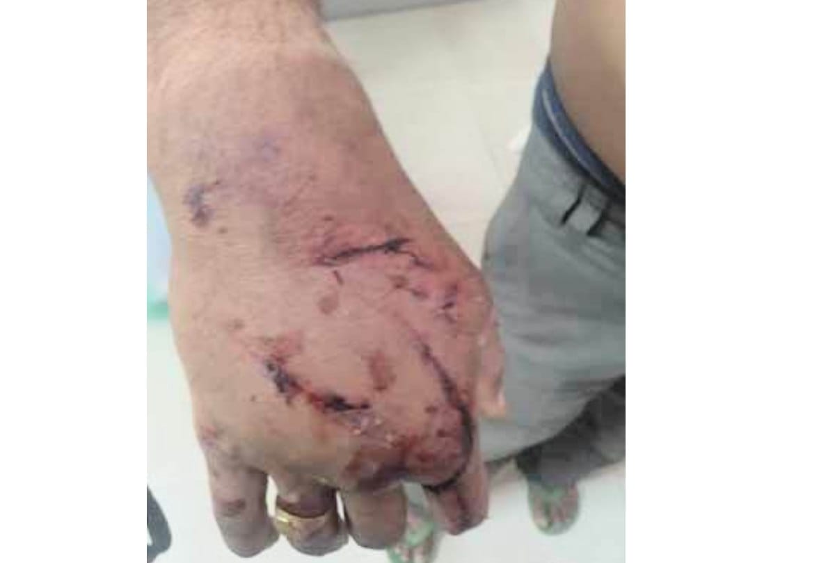 Husband beaten by wife in Sirmour Himachal Pradesh