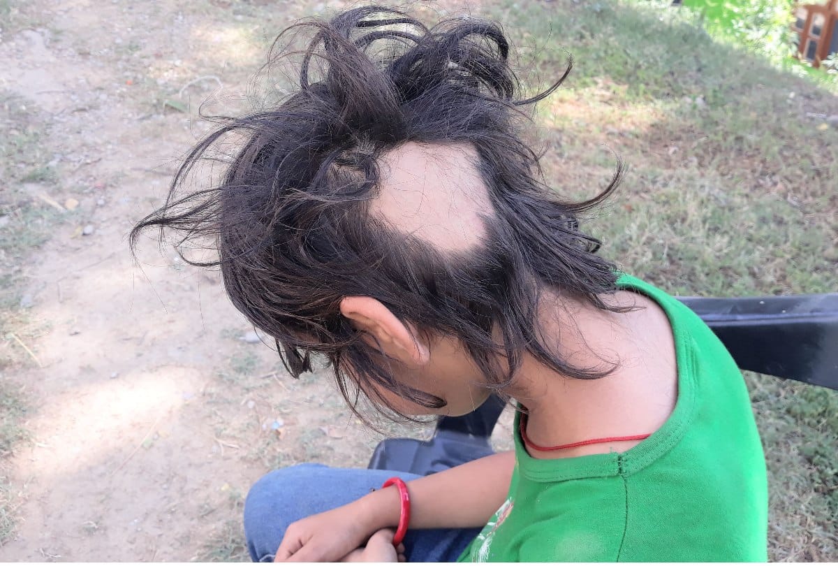 Mandi Himachal: Woman Teacher transferred who Pulls Out Hair Of 3rd Standard Student