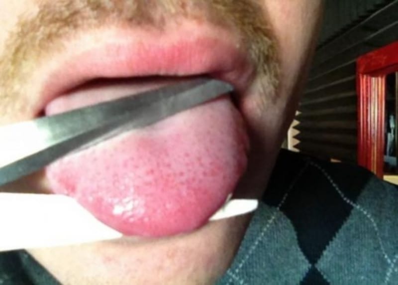 man tongue cut for loving married women