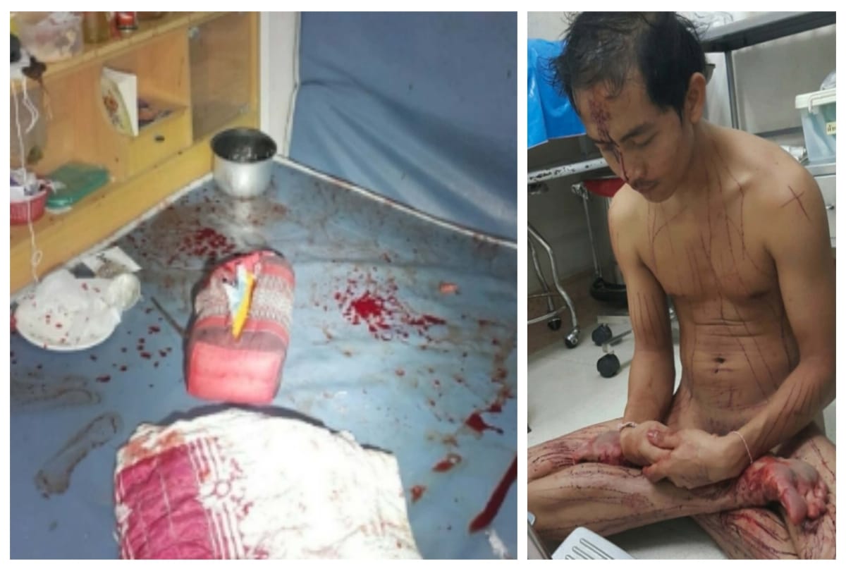 Man cut his genitals while watching adult film in Thailand