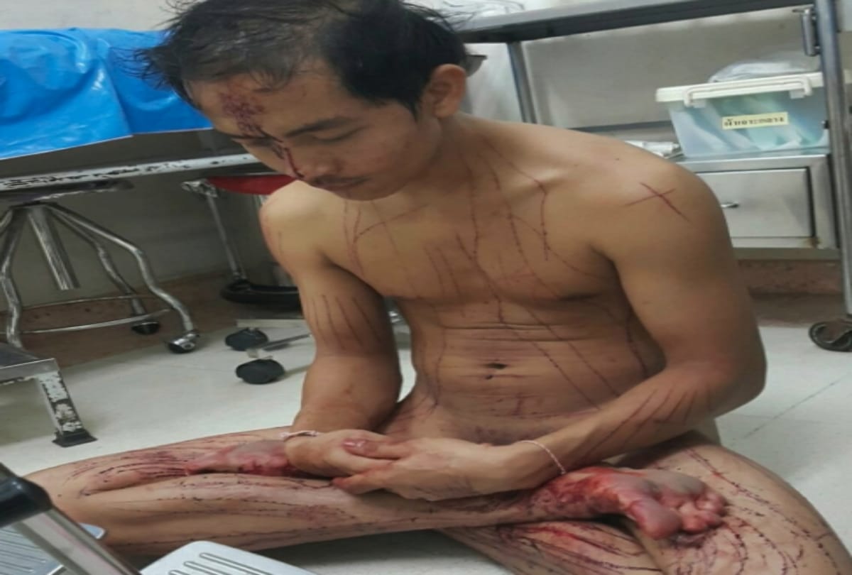 Man cut his genitals while watching adult film in Thailand