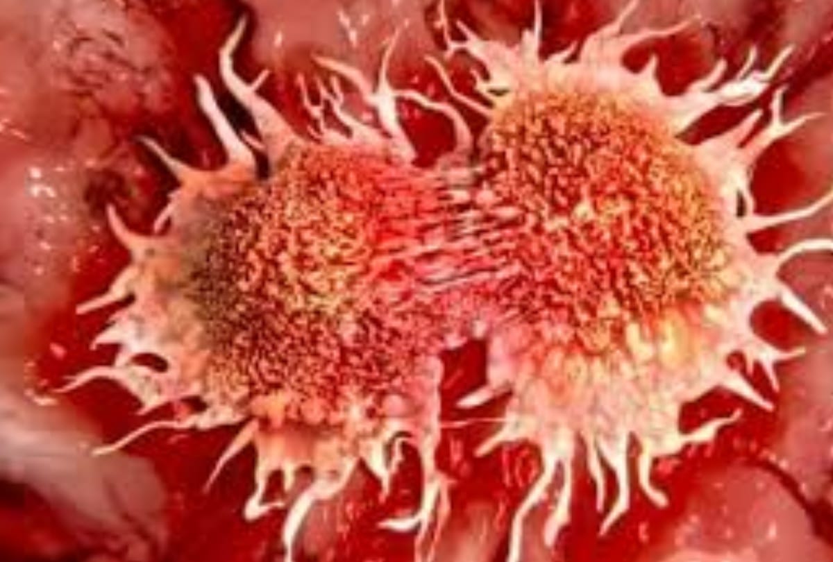 opd will start in cancer institute from november