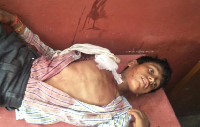 बाइक सवार बदमाशों ने पिता पुत्र को गोली मारी