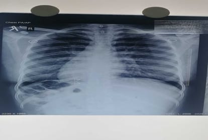 The patient's heart, liver, multiple organ in the opposite direction within the body