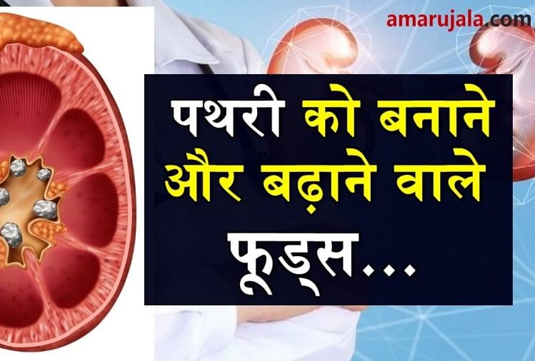 foods-can-cause-you-kidney-stone-amar-ujala-hindi-news-live