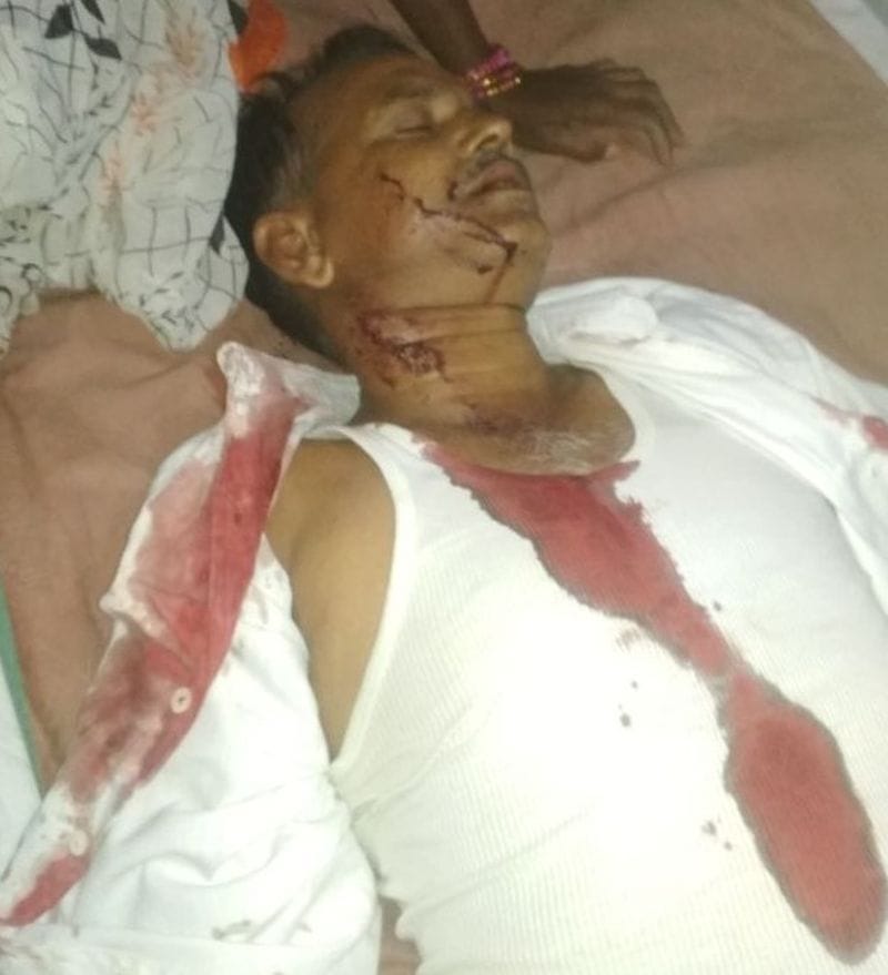 अलीगंज के पुराहार में दो पक्षों में फायरिंग, तीन घायल