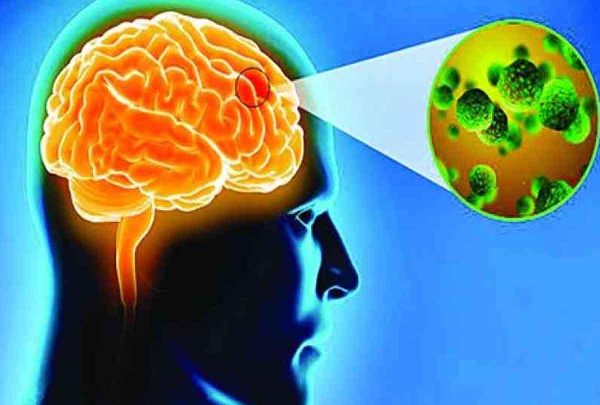 Danger of viral encephalitis spreading