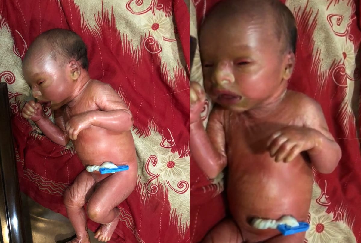 american doctors will research on plastic baby