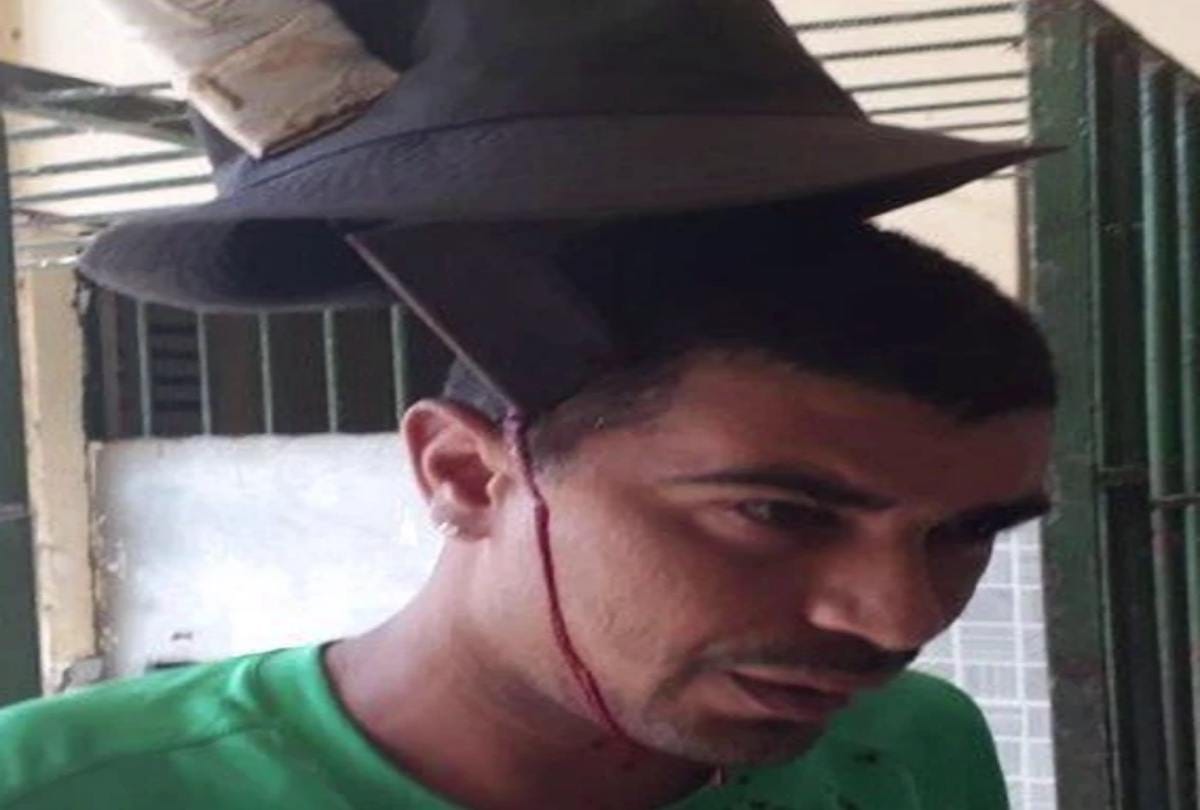 A man walking around machete stuck head at hospital in brazil