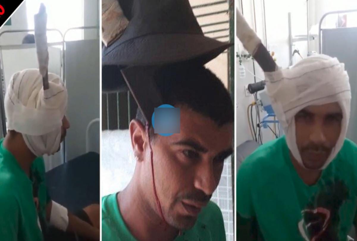 A man walking around machete stuck head at hospital in brazil