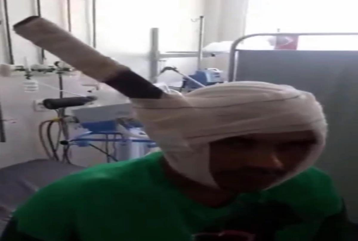 A man walking around machete stuck head at hospital in brazil