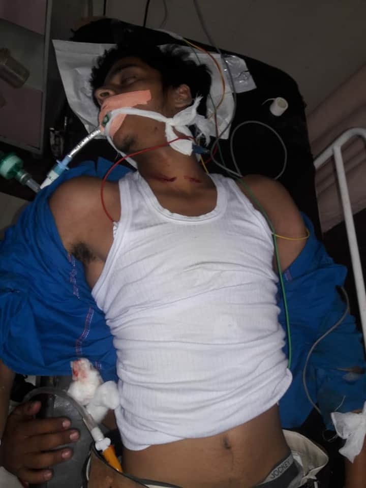 Bus and bike accident in dehradun two boys injured photos