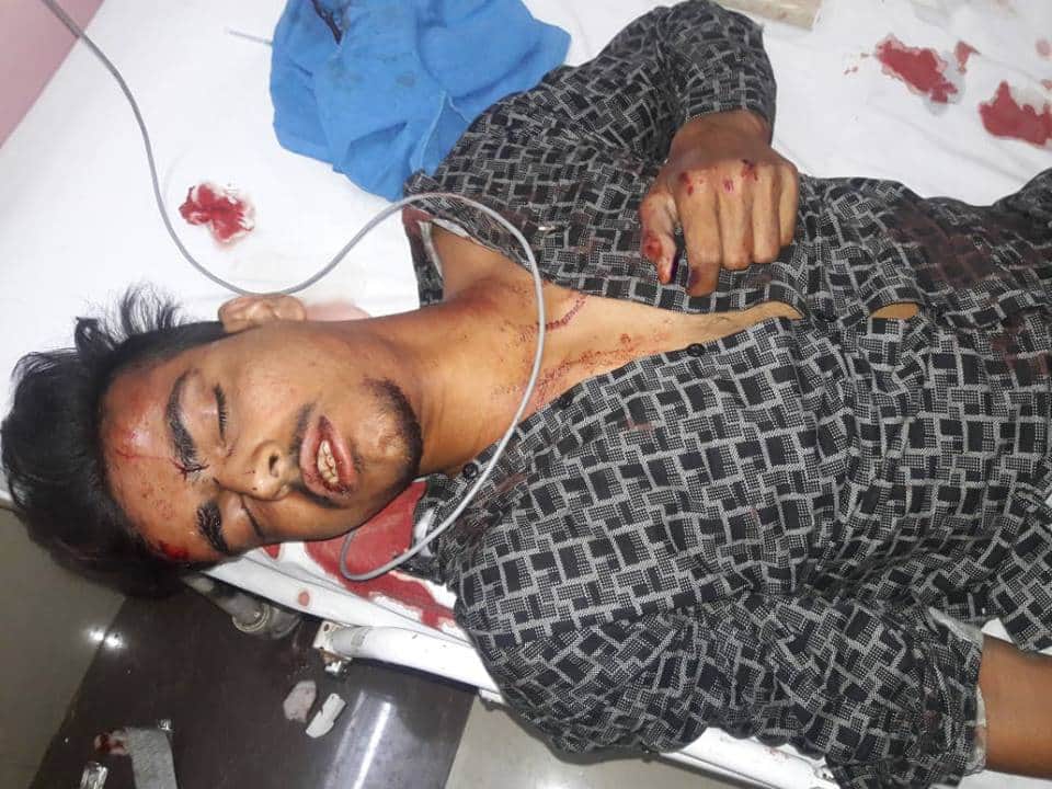 Bus and bike accident in dehradun two boys injured photos